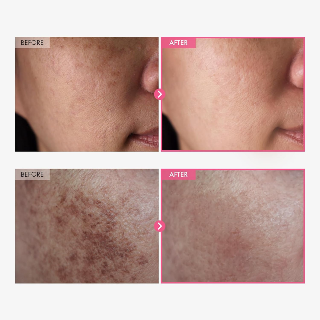 Korean Brightening Cream