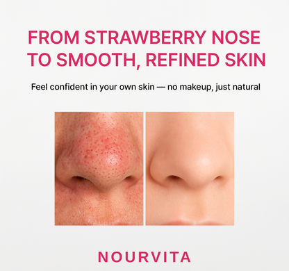 NourVita PoreThera Sonic™